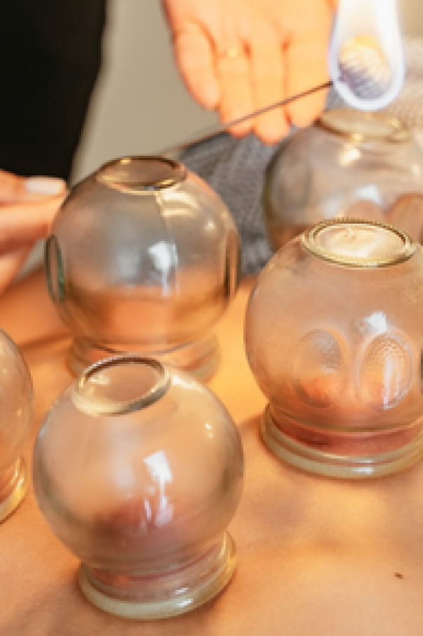 Cạo Gió Giác Hơi